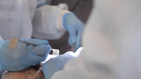 Dentists perform surgery. Stock Footage 95853782