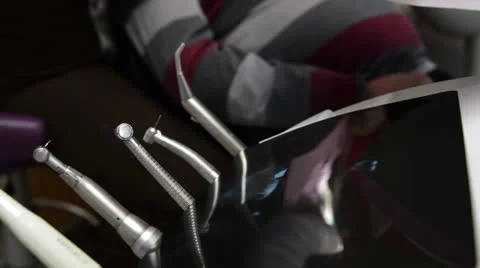Dentist's reflection in xray Stock Footage 24820728