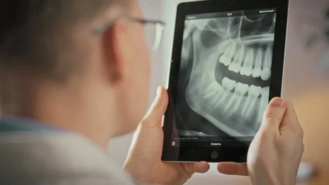 Dentists skilled hands analyze panoramic X-ray on sensor device zooming into Stock Footage 343857474
