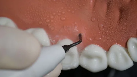 Dentist's tool simulating operation ultrasound gums Stock Footage 128453462