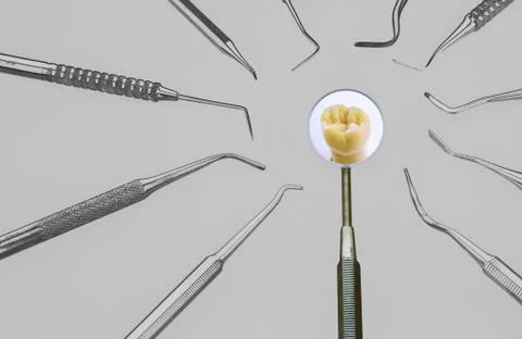 Dentist's tools and a tooth in a mirror Foto stock