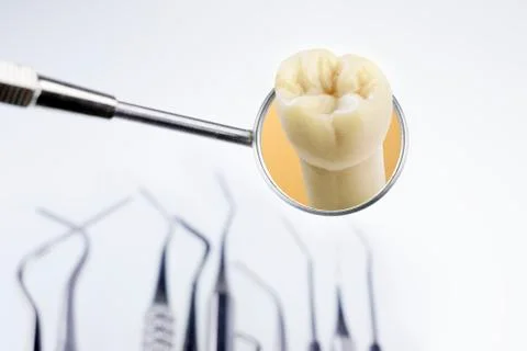 Dentist's tools and tooth model in a dentists mirror Foto stock