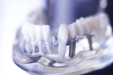 Dentsts dental teeth model Stock Photos