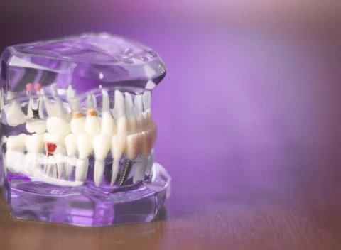 Denture for dentistry students Foto stock