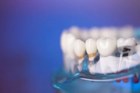 Denture for dentistry students Stock Photos