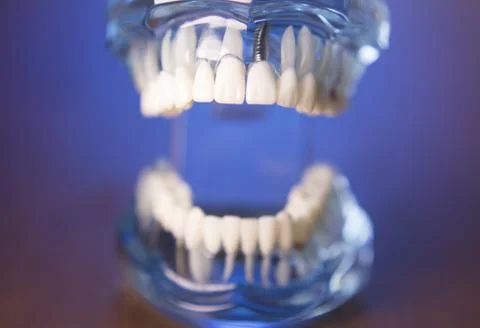 Denture for dentistry students Stock-Fotos