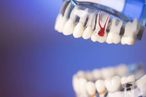 Denture for dentistry students Stock Photos