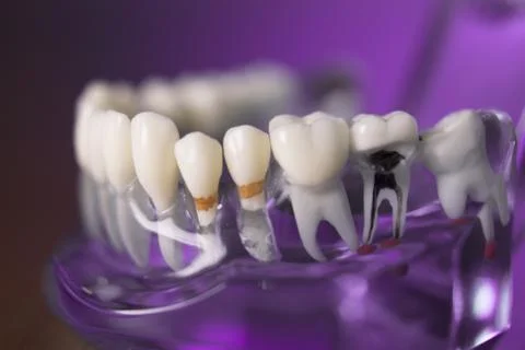 Denture for dentistry students Foto stock