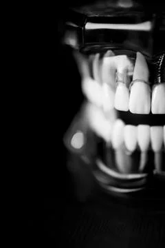 Denture for dentistry students Stock Photos