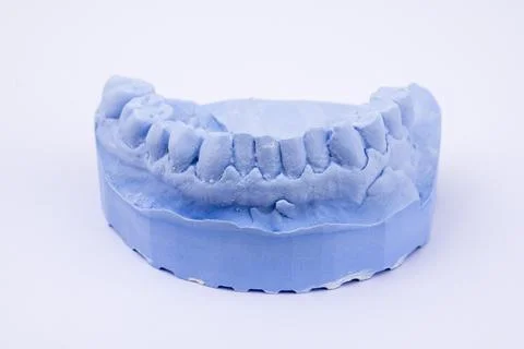 Denture impression of an upper jaw for dentures dentist dental impression Stock Photos
