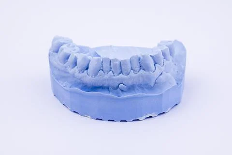 Denture impression of an upper jaw for dentures dentist dental impression Stock Photos