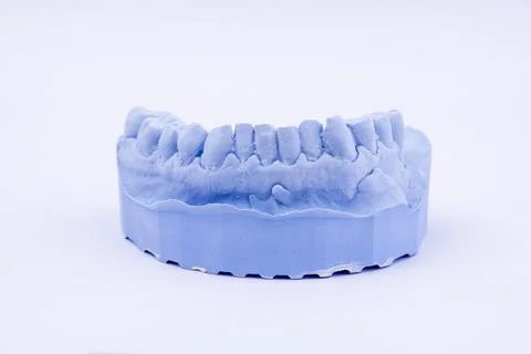 Denture impression of an upper jaw for dentures dentist dental impression Stock Photos