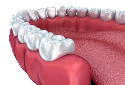 Denture isolated on white . Medically accurate 3D illustration Stock Illustration