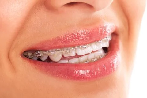 Denture Stock Photos