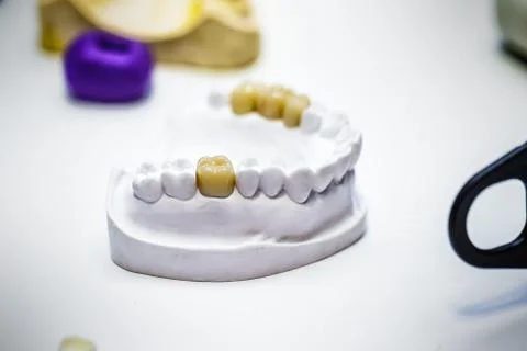 The denture sample Stock Photos