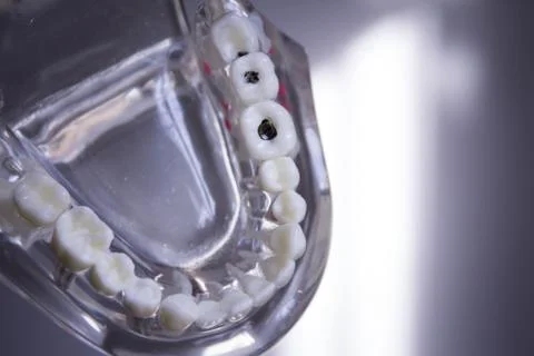 Denture for students transparent Stock Photos