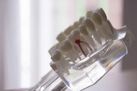 Denture for students transparent 스톡 사진