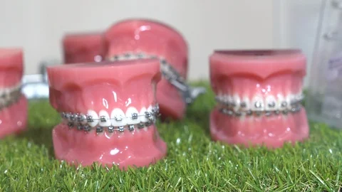 Denture Teeth Braces Video stock 92673904