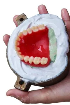 Denture wax model on plaster Stock-Fotos