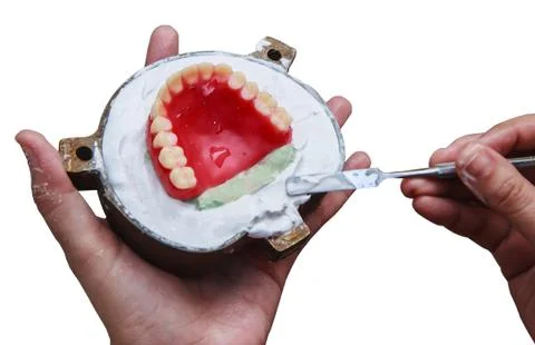 Denture wax model on plaster Stock-Fotos