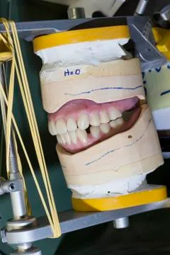 Denture work in progress Stock Photos
