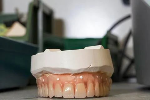 Denture work in progress Stock Photos