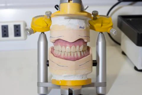 Denture work in progress Stock Photos