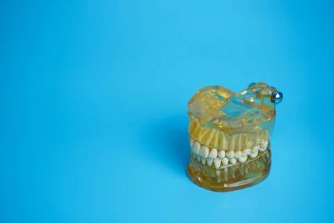 Dentures on a blue background.Upper and lower jaws with false teeth. Dentur.. Stock-Fotos