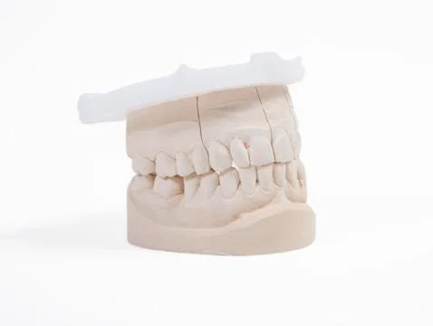 Dentures copy Stock-Fotos