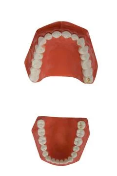 Dentures, dental prosthesis Foto stock