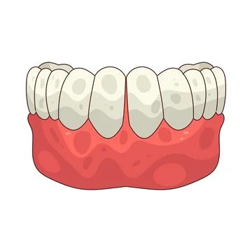 Dentures illustration Stock Illustration