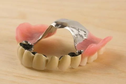Dentures with metal-ceramic crowns Stock Photos