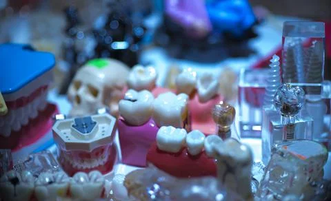 Dentures, a model of the teeth, jaw model for studying dentistry on the backg Stock Photos