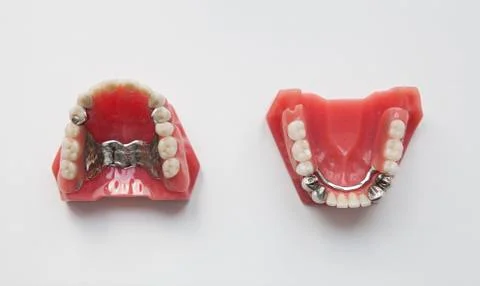 Dentures 写真素材