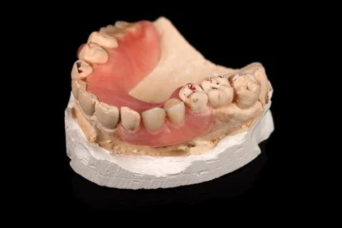 Dentures on a plaster cast 스톡 사진