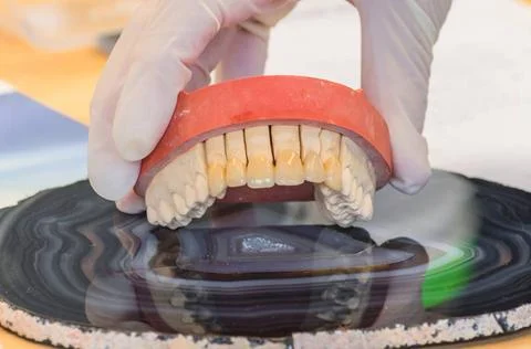 Dentures, prosthesis Dentures, prosthesis and oral hygiene. Hands with glo... 스톡 사진