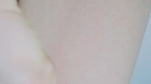 Depilation of the skin close-up. 库存影片 115448498