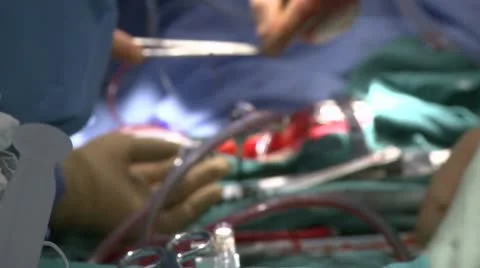 Depth of field of heart surgery (2 of 2) Stock Footage 10679845
