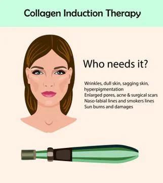Dermapen. Microneedle stamping device isolated. Collagen induction therapy Stock Illustration