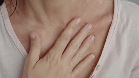 Dermatitis on the skin of the neck Video stock 118644191