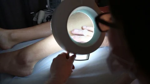 A dermatologist examines the skin on the body of a young man through a Stock Footage