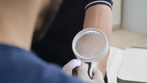 Dermatologist Examining Elbow through Magnifying Glass for Skin Problems 스톡 동영상 322520764
