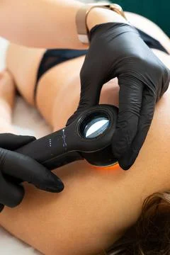 Dermatologist Examining a Mole Using a Dermatoscope Фото