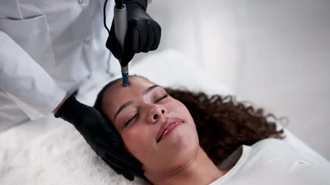 Dermatologist Performs Microneedling Therapy Видео 327518065
