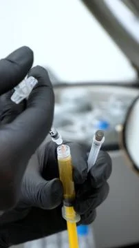 Dermatologist Preparing PRP Injection, Close-Up of Hands and Syringe Stock Photos