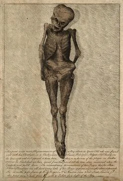 The desiccated corpse of a boy, about twelve years old, found in a vault un.. Ilustración de archivo