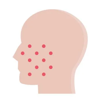 Design vector image icons pimples Stock Illustration