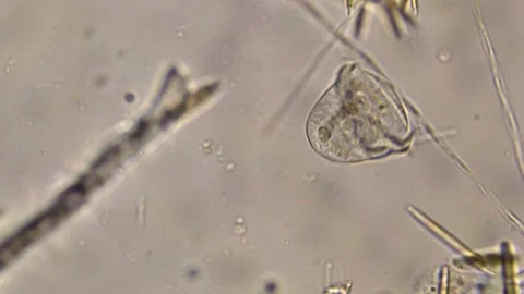 Detached vorticella with no stem Stock Footage 303105026