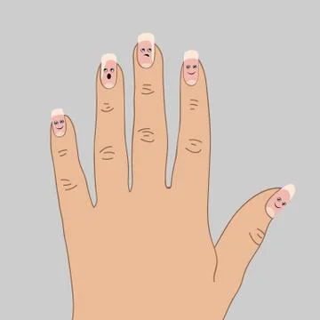 Detachment of the nail plate from the nail bed. Stock Illustration