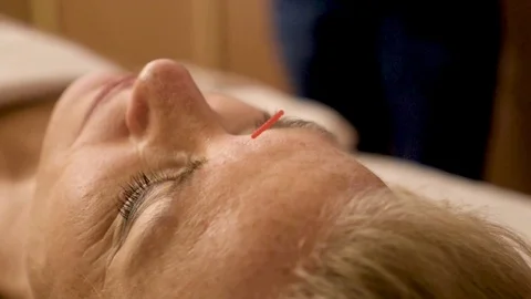 88 Electro Acupuncture Stock Video Footage - 4K and HD Video Clips